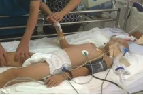 Ngã cây, bé trai ở miền Tây dập tủy sống, liệt 2 tay