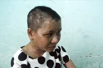 Lộ thêm đòn tra tấn thiếu nữ man rợ của bà chủ mất nhân tính ở Gia Lai