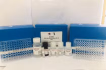 “Ăn đứt” hàng ngoại, kit thương hiệu Việt chẩn đoán nhanh 3 bệnh bẩm sinh