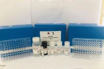 “Ăn đứt” hàng ngoại, kit thương hiệu Việt chẩn đoán nhanh 3 bệnh bẩm sinh