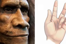 Giải bí ẩn “căn bệnh Viking”: Có nguồn gốc từ người Neanderthal?