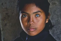 Kỳ lạ cô gái có đôi mắt hai màu ở Ninh Thuận