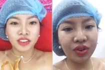 Phượng “Thị Nở” livestream cảnh phẫu thuật “vùng kín” gây sốc