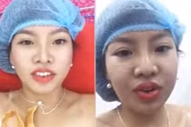 Phượng “Thị Nở” livestream cảnh phẫu thuật “vùng kín” gây sốc