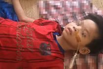 Thương tâm cậu bé bị cắt dạ dày vì uống nhầm axit