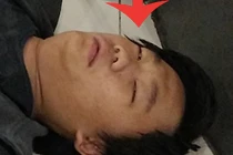 Vạch mặt trai trẻ đi muôn nơi giả ngất để ăn xin 