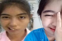 Nữ sinh mồm lệch gây choáng váng với nhan sắc hiện tại