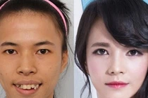 Nữ sinh Việt 20 năm đeo khẩu trang "lột xác" ngoạn mục