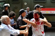 Cảnh sát giải tán biểu tình ở Cairo, 120 người thương vong