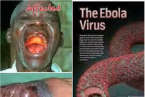 90% trường hợp mắc sốt xuất huyết Ebola sẽ tử vong