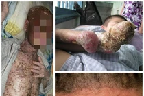 Top căn bệnh “thách đố” y học Việt Nam năm 2013