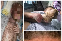 Top căn bệnh “thách đố” y học Việt Nam năm 2013