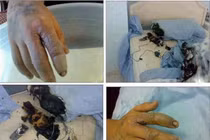 Bỏng da, bong võng mạc, vô sinh... vì điện thoại 