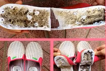 Thực hư dép Trung Quốc chứa chất lạ gây tê, liệt chân
