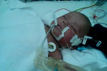 Sử dụng hạt mùi đúng cách phòng sởi 