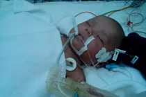 Sử dụng hạt mùi đúng cách phòng sởi 