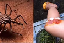 Cách nhận biết, tiêu diệt và phòng tránh bọ xít hút máu 