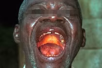 Ebola có thể vào Việt Nam qua con đường nào?