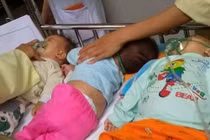 Thêm 250 ca mắc sởi trong đợt nghỉ lễ 30/4 - 1/5