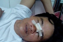 Công an bị tố vô cớ bắn người trọng thương 