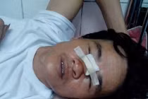 Công an bị tố vô cớ bắn người trọng thương 