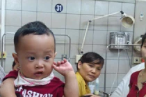 Cứu sống bệnh nhi bị sởi biến chứng viêm não nguy kịch