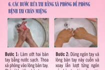 Hướng dẫn phòng bệnh tay chân miệng bằng hình ảnh