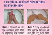 Hướng dẫn phòng bệnh tay chân miệng bằng hình ảnh