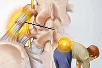 Các cách đứng, ngồi để tránh thoát vị đĩa đệm