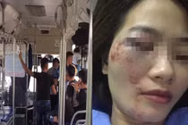 Khởi tố vụ án nhóm thanh niên đánh nữ phụ xe buýt nhập viện 