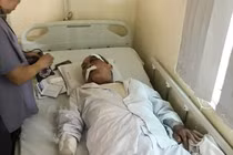 Cụ ông 80 ngày thứ 2 đi làm xe ôm bị đánh gãy xương kể lại phút kinh hoàng