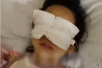 Phẫu thuật mắt phải bị mổ cả mắt trái, bệnh viện giải thích sốc 