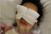 Phẫu thuật mắt phải bị mổ cả mắt trái, bệnh viện giải thích sốc 