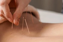 Đi châm cứu, cô gái tủi nhục khi bị bác sĩ làm điều này