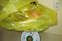 Bất ngờ phát hiện khối u 1,5kg trong tử cung