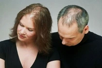 Tóc mỏng, hay rụng, làm gì để cải thiện?