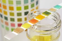 Nước tiểu tiết lộ gì về sức khỏe của bạn?