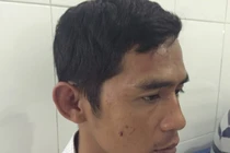 Hàng chục đầu gấu đánh tài xế xe khách ngất xỉu