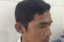 Hàng chục đầu gấu đánh tài xế xe khách ngất xỉu