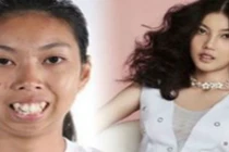 Hành trình lột xác thành mỹ nhân của cô gái xấu xí 