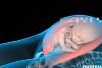 Những điều nên biết về đẻ mổ ở phụ nữ