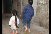 Bệnh lạ khiến người giống ếch ở Hà Nội