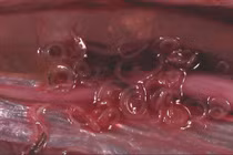 Tận mắt xem ký sinh trùng lúc nhúc trong cá thu siêu thị