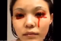 Rùng mình với cô gái khóc ra máu khi đang ngủ