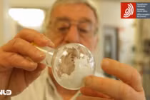 Đã có thuốc chữa dứt điểm bệnh viêm gan siêu vi B