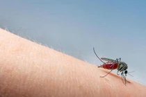 Cách trị nốt muỗi đốt không để lại vết thâm bằng xà bông