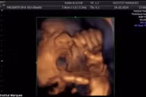 Xem thai nhi hát trong bụng mẹ như thần đồng