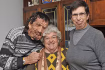 Hãi hùng các chứng bệnh hiếm gặp nhất trên thế giới