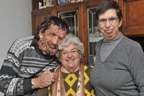 Hãi hùng các chứng bệnh hiếm gặp nhất trên thế giới