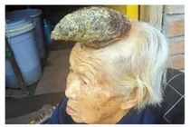 Cụ bà mọc "sừng" như kỳ lân kỳ lạ ở Trung Quốc